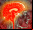 Implante cerebral permite a mudo hablar Implante cerebral permite a mudo hablar