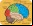 Implante cerebral permite a mudo hablar Implante cerebral permite a mudo hablar